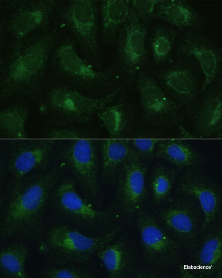 Immunohistochemistry of paraffin-embedded Rat kidney using TPI1 Polyclonal Antibody at dilution of  1:100 (40x lens).