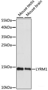 Immunohistochemistry of paraffin-embedded Mouse spleen using BTK Polyclonal Antibody at dilution of  1:100 (40x lens).
