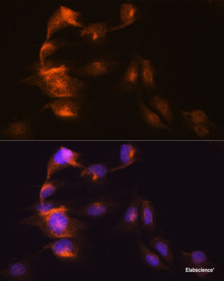 Immunohistochemistry of paraffin-embedded Rat heart using KIF1C Polyclonal Antibody at dilution of  1:100 (40x lens).