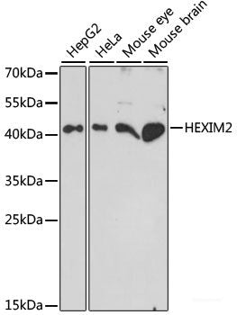 Immunofluorescence analysis of U2OS cells using DICER1 Polyclonal Antibody at dilution of  1:100. Blue: DAPI for nuclear staining.