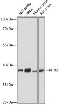 Immunohistochemistry of paraffin-embedded Mouse brain using Androgen Receptor Polyclonal Antibody 