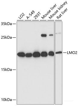Immunohistochemistry of paraffin-embedded Rat spleen using FGFR2 Polyclonal Antibody at dilution of  1:100 (40x lens).