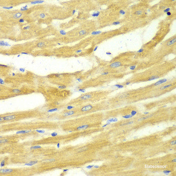 Immunohistochemistry of paraffin-embedded Rat kidney using MT1-MMP Polyclonal Antibody at dilution of  1:100 (40x lens).