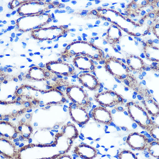 Immunohistochemistry of paraffin-embedded Human stomach using RETN Polyclonal Antibody at dilution of  1:100 (40x lens).