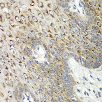Immunohistochemistry of paraffin-embedded Rat pancreatic islet using DLK1 Polyclonal Antibody at dilution of  1:200 (40x lens).