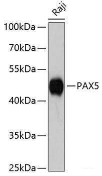 Immunofluorescence analysis of Y79 cells using ANO2 Polyclonal Antibody at dilution of  1:100 (40x lens). Blue: DAPI for nuclear staining.