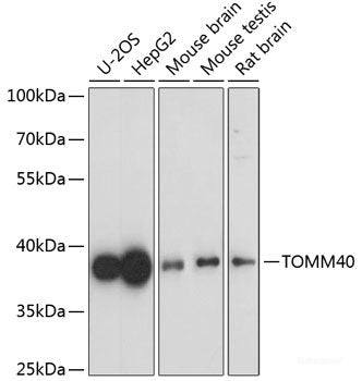 Immunohistochemistry of paraffin-embedded Human lung cancer using IFIT3 Polyclonal Antibody at dilution of  1:100 (40x lens).