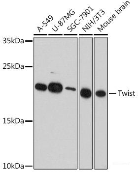 Immunohistochemistry of paraffin-embedded Human liver damage using ITPKB Polyclonal Antibody at dilution of  1:100 (40x lens).