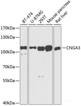 Western blot analysis of extracts of various cell lines using PGAM1 Polyclonal Antibody at dilution of 1:1000.