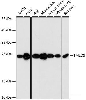 Immunohistochemistry of paraffin-embedded Rat brain using VARS Polyclonal Antibody at dilution of  1:100 (40x lens).