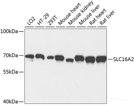 Immunohistochemistry of paraffin-embedded Human stomach using PMPCB Polyclonal Antibody at dilution of  1:100 (40x lens).
