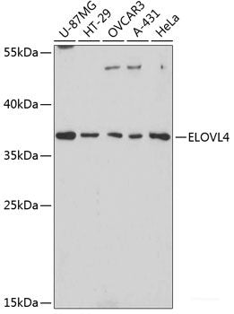 Immunofluorescence analysis of U2OS cells using FXR2 Polyclonal Antibody at dilution of  1:100. Blue: DAPI for nuclear staining.