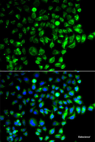 Immunofluorescence analysis of Rat lung using ABCG1 Polyclonal Antibody at dilution of  1:100. Blue: DAPI for nuclear staining.