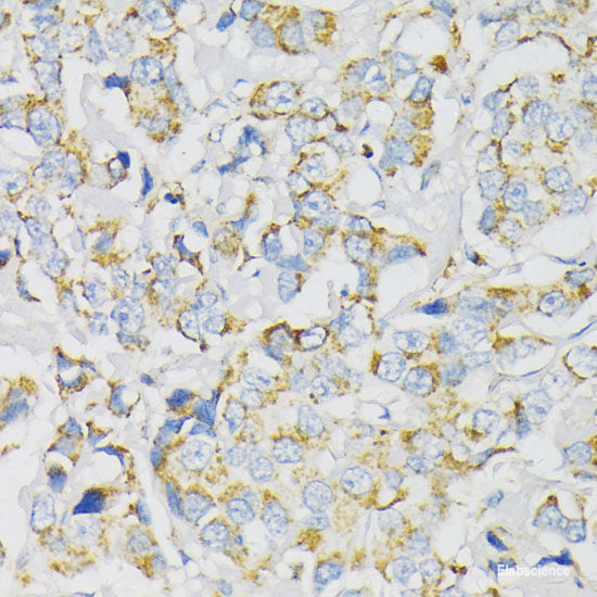 Immunohistochemistry of paraffin-embedded Rat brain using TRAP1 Polyclonal Antibody at dilution of  1:100 (40x lens).