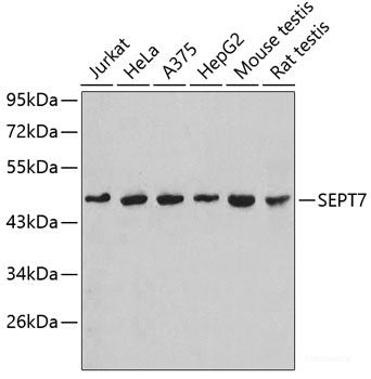 Immunohistochemistry of paraffin-embedded Rat lung using CRTAP Polyclonal Antibody at dilution of  1:100 (40x lens).