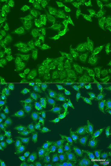 Immunohistochemistry of paraffin-embedded Human prostate using NOV Polyclonal Antibody at dilution of  1:100 (40x lens).