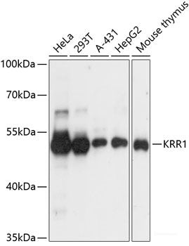 Immunohistochemistry of paraffin-embedded Rat brain using PRKACB Polyclonal Antibody at dilution of  1:100 (40x lens).