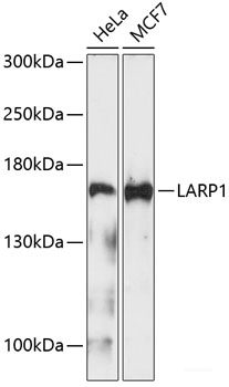 Western blot analysis of extracts of various cell lines using TRPM8 Polyclonal Antibody at dilution of 1:500.