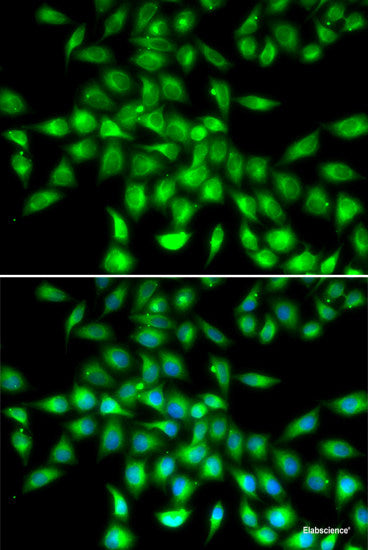 Immunohistochemistry of paraffin-embedded Rat brain using ID3 Polyclonal Antibody at dilution of  1:200 (40x lens).