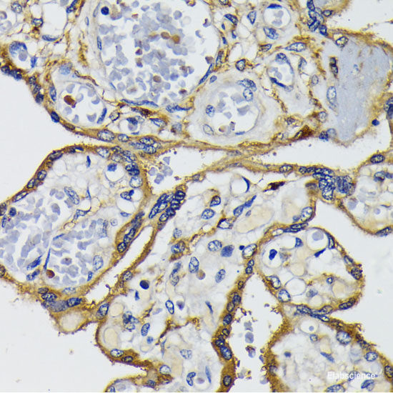 Immunohistochemistry of paraffin-embedded Mouse lung using FBXW7 Polyclonal Antibody at dilution of  1:100 (40x lens).
