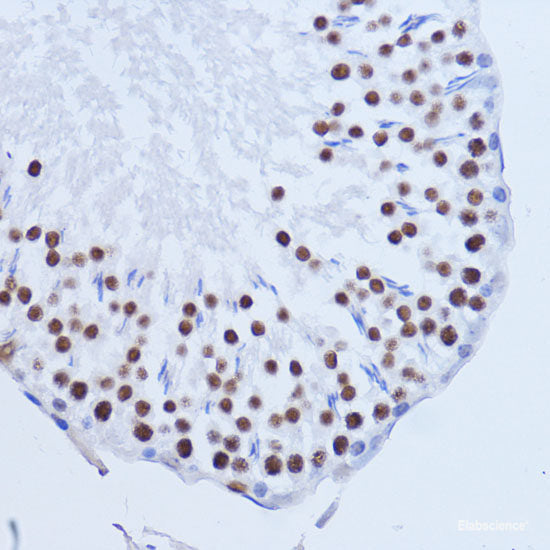 Immunohistochemistry of paraffin-embedded Rat brain using AKTIP Polyclonal Antibody at dilution of  1:100 (40x lens).
