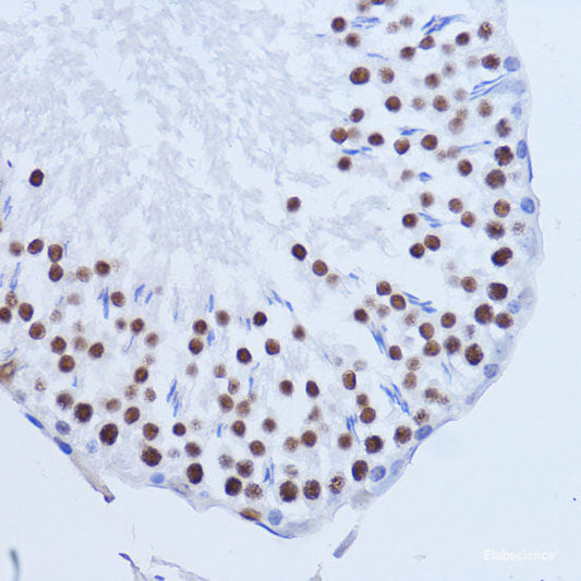 Immunohistochemistry of paraffin-embedded Rat brain using AKTIP Polyclonal Antibody at dilution of  1:100 (40x lens).