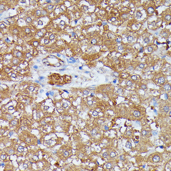 Immunohistochemistry of paraffin-embedded Rat brain using RARS Polyclonal Antibody at dilution of  1:100 (40x lens).