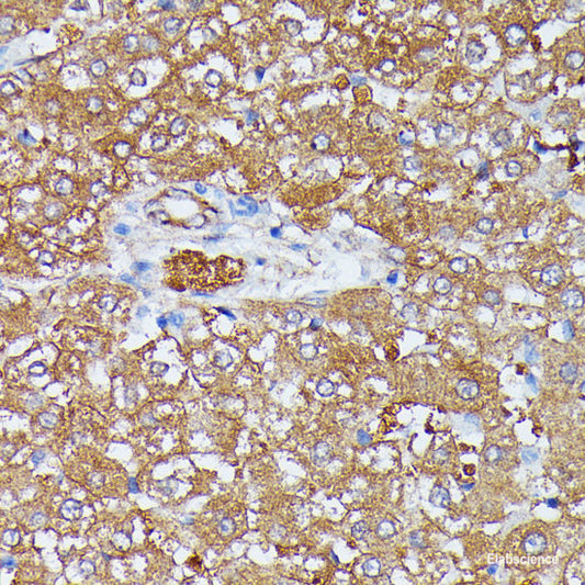 Immunohistochemistry of paraffin-embedded Rat brain using RARS Polyclonal Antibody at dilution of  1:100 (40x lens).