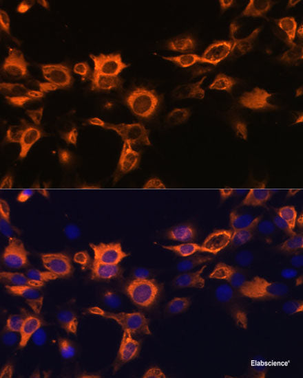 Immunohistochemistry of paraffin-embedded Rat kidney using ELF3 Polyclonal Antibody at dilution of  1:200 (40x lens).