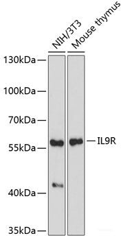 Immunohistochemistry of paraffin-embedded Human prostate using TSHB Polyclonal Antibody at dilution of  1:100 (40x lens).