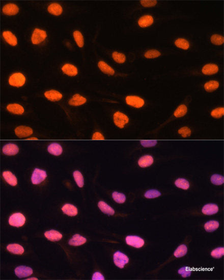 Immunohistochemistry of paraffin-embedded Human kidney cancer using TCEB3 Polyclonal Antibody at dilution of  1:100 (40x lens).