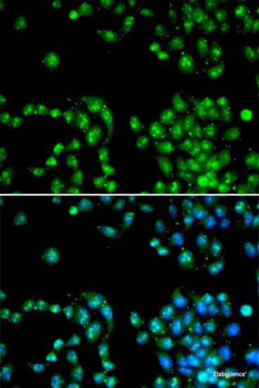 Immunohistochemistry of paraffin-embedded Mouse kidney using FKBP6 Polyclonal Antibody at dilution of  1:100 (40x lens).