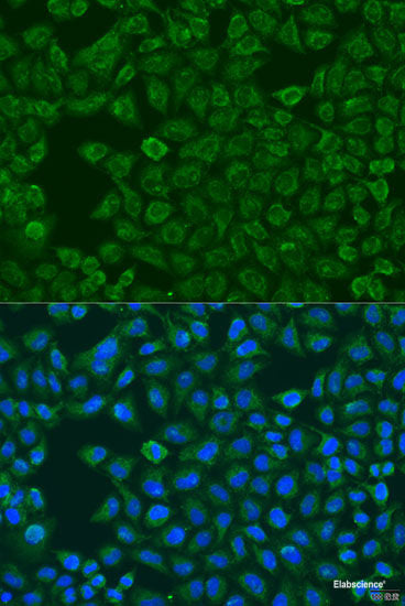 Immunohistochemistry of paraffin-embedded Rat lung using LRG1 Polyclonal Antibody at dilution of  1:100 (40x lens).