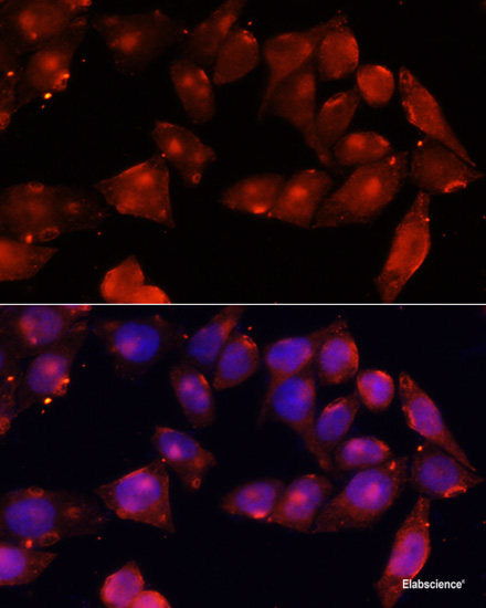 Immunofluorescence analysis of Rat retina using RDH5 Polyclonal Antibody at dilution of  1:100 (40x lens). Blue: DAPI for nuclear staining.