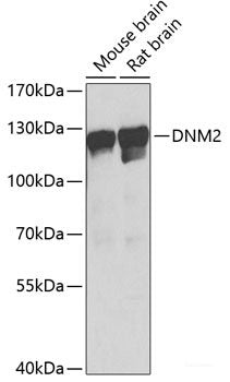 Immunohistochemistry of paraffin-embedded Human esophagus using ADH1C Polyclonal Antibody at dilution of  1:100 (40x lens).