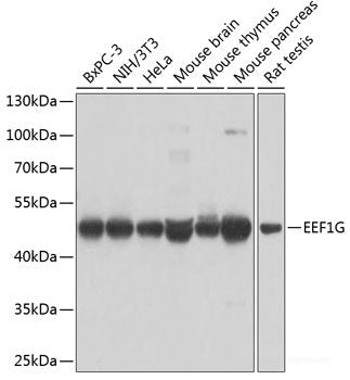 Immunohistochemistry of paraffin-embedded Rat kidney using NEDD4L Polyclonal Antibody at dilution of  1:200 (40x lens).