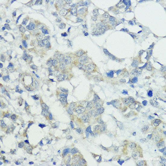 Immunofluorescence analysis of U2OS cells using STXBP3 Polyclonal Antibody at dilution of  1:100. Blue: DAPI for nuclear staining.