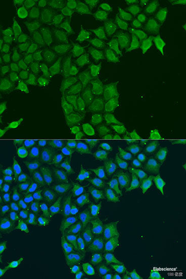 Immunohistochemistry of paraffin-embedded Rat heart using PITRM1 Polyclonal Antibody at dilution of  1:100 (40x lens).