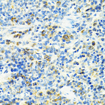 Immunohistochemistry of paraffin-embedded Rat kidney using ATP7A Polyclonal Antibody at dilution of  1:100 (40x lens).