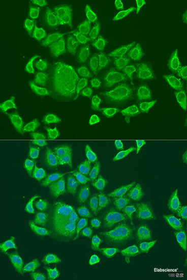 Immunohistochemistry of paraffin-embedded Human liver damage using UVRAG Polyclonal Antibody at dilution of  1:100 (40x lens).