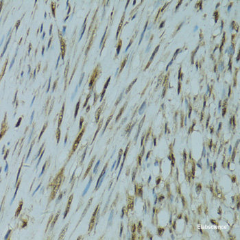 Immunohistochemistry of paraffin-embedded Human liver damage using KCNK9 Polyclonal Antibody at dilution of  1:100 (40x lens).