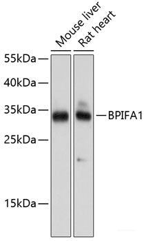Immunohistochemistry of paraffin-embedded Rat testis using CTAG1B Polyclonal Antibody at dilution of  1:100 (40x lens).