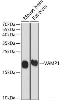 Confocal immunofluorescence analysis of U2OS cells using MRPS16 Polyclonal Antibody at dilution of  1:100. Blue: DAPI for nuclear staining.