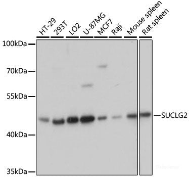 Immunohistochemistry of paraffin-embedded Human prostate using POMGNT1 Polyclonal Antibody at dilution of  1:100 (40x lens).