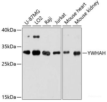 Immunohistochemistry of paraffin-embedded Mouse lung using HPR Polyclonal Antibody at dilution of  1:100 (40x lens).