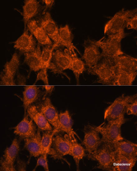 Immunohistochemistry of paraffin-embedded Human liver using KIR3DS1 Polyclonal Antibody at dilution of  1:100 (40x lens).