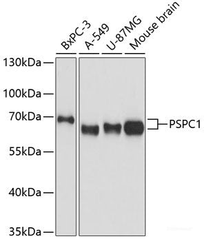 Immunofluorescence analysis of C6 cells using PDHA2 Polyclonal Antibody at dilution of  1:100 (40x lens). Blue: DAPI for nuclear staining.