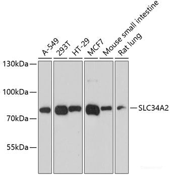 Immunohistochemistry of paraffin-embedded Rat spleen using UQCC2 Polyclonal Antibody at dilution of  1:100 (40x lens).