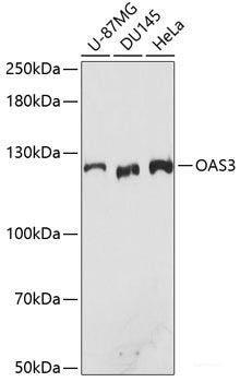 Immunohistochemistry of paraffin-embedded Human gastric cancer using SLC2A13 Polyclonal Antibody at dilution of  1:100 (40x lens).