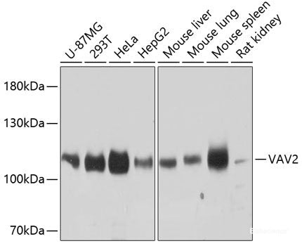 Immunohistochemistry of paraffin-embedded Rat heart using FRMD6 Polyclonal Antibody at dilution of  1:100 (40x lens).